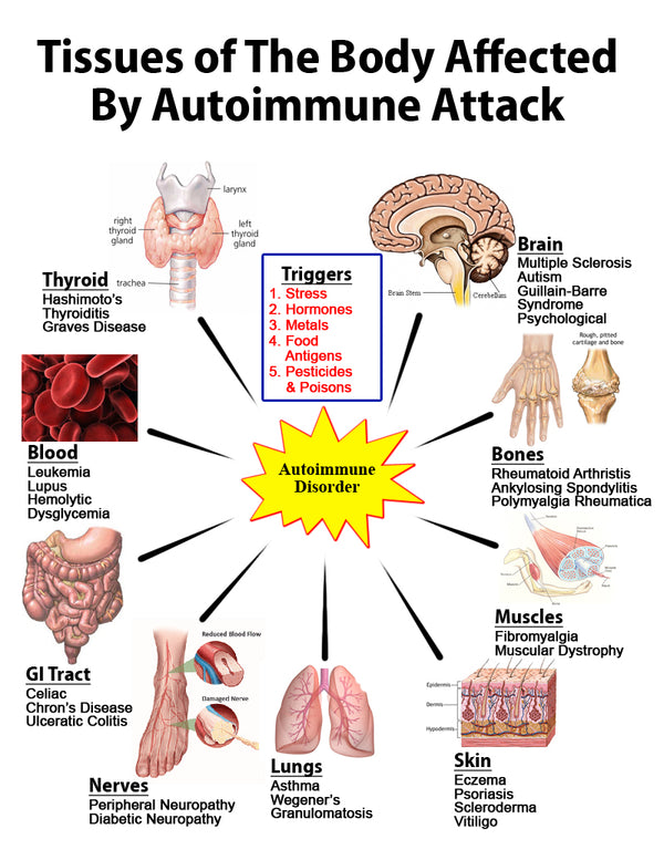 BEWARE OF GLUTEN! ALL ABOUT AUTOIMMUNE DISEASES and GLUTEN (ROOT CHAKRA)